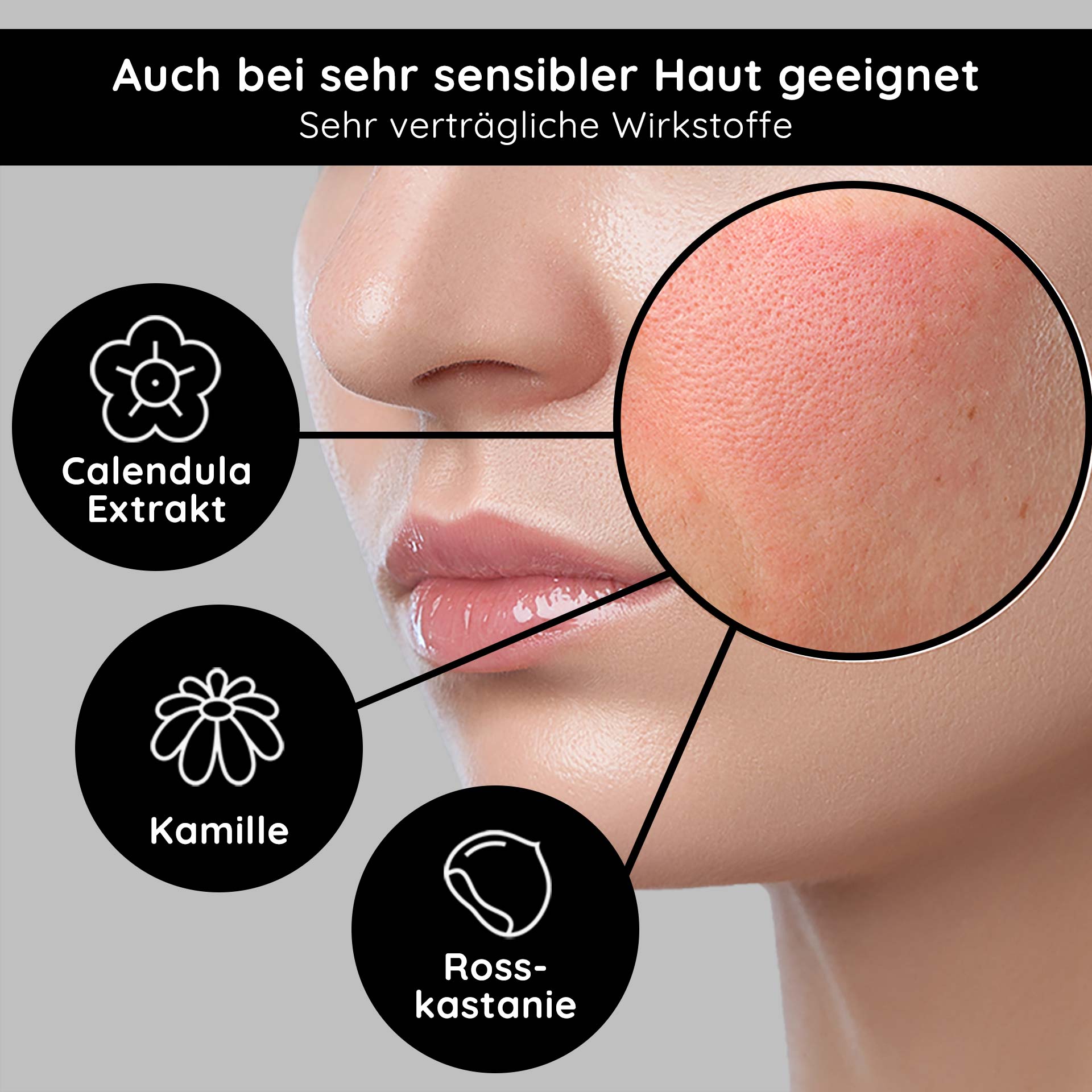 红斑痤疮抗敏精华素 50 毫升 Gesichtshaut mit sichtbaren Rötungen, hervorgehobene Inhaltsstoffe: Calendula Extrakt, Kamille, Rosskastanie, geeignet für empfindliche Haut.