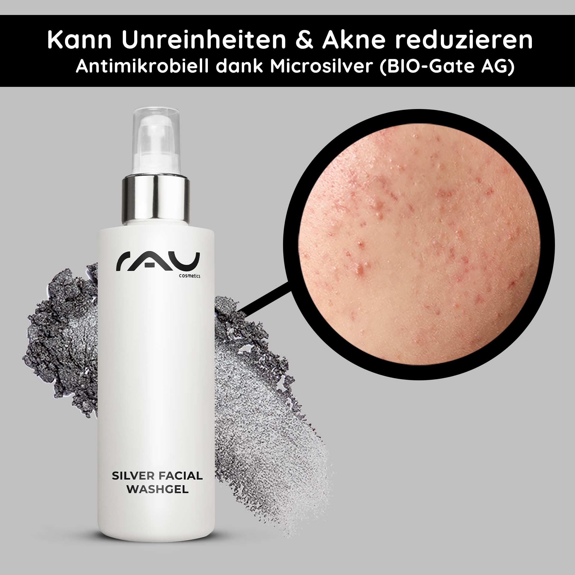 200 毫升微银洁面乳 Flasche RAU Silver Facial Washgel mit antimikrobiellem Mikrosilber, Nahaufnahme von Haut mit Akne und Unreinheiten, mit Hervorhebung der Vorteile für empfindliche und zu Akne neigende Haut.