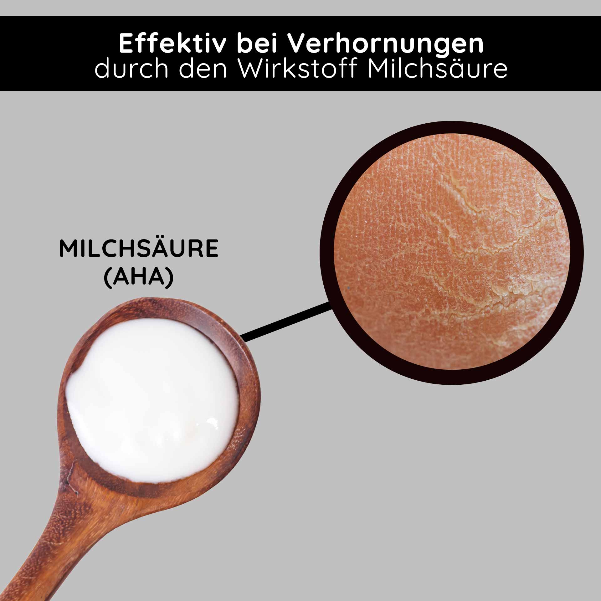 果酸和 BHA 乳霜 50 毫升 - BHA 果酸乳霜 Milchsäure (AHA) in einem Holzlöffel, wirksam gegen Verhornungen, mit Hauttextur im Detail.