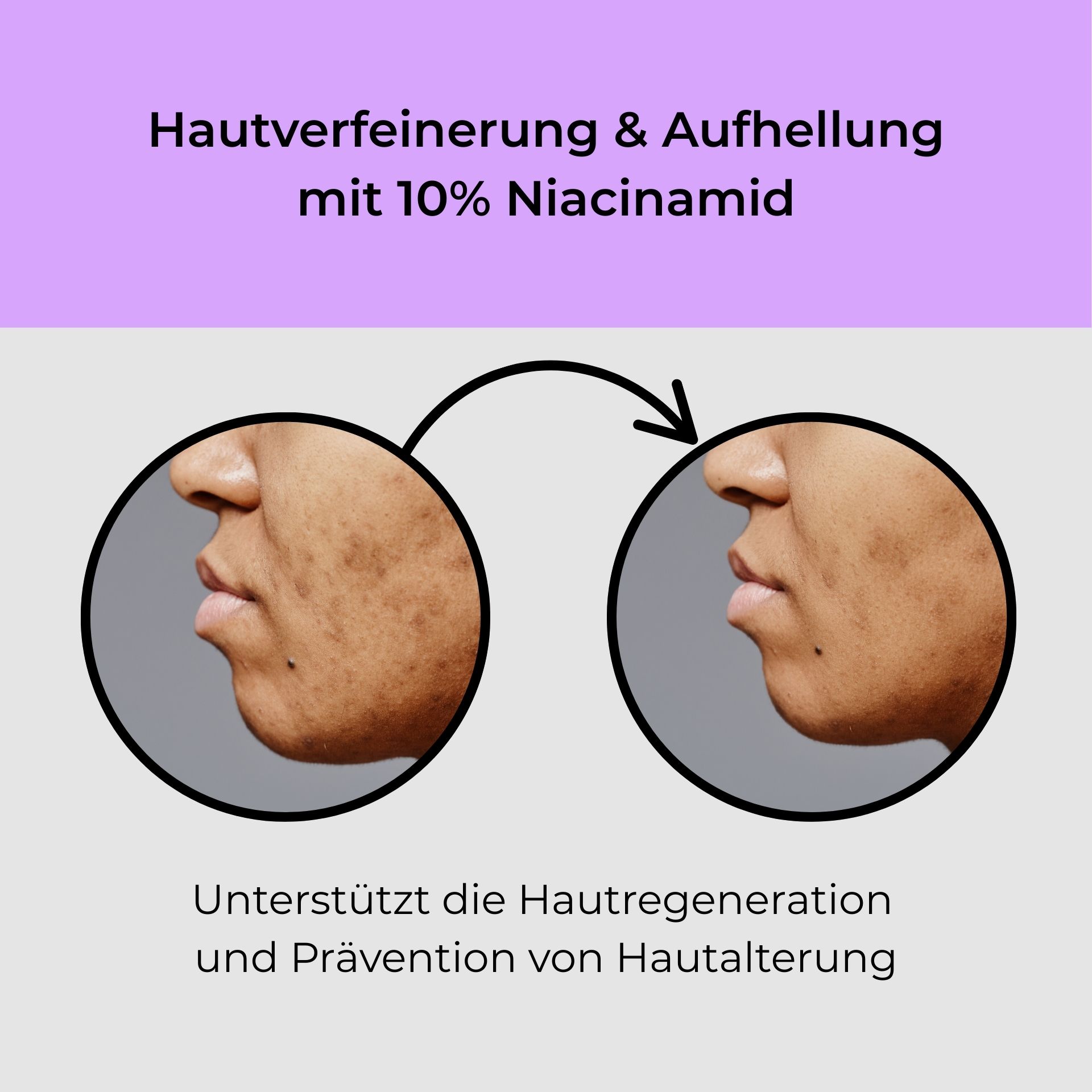 Kopf, Person, Gesicht