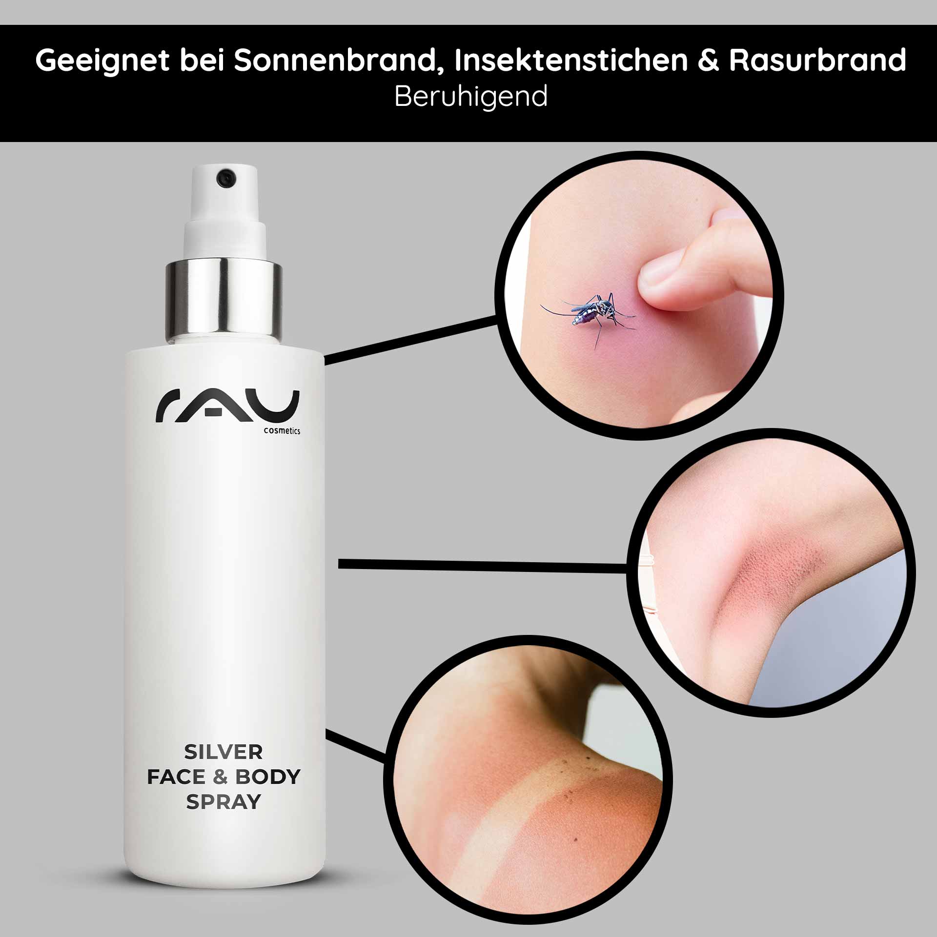 银离子面部和身体喷雾 200 毫升,含泛醇和微银 Silver Face & Body Spray von RAU Cosmetics, geeignet zur Linderung von Sonnenbrand, Insektenstichen und Rasurbrand, mit sichtbaren Beispielen für Hautirritationen und einem eleganten Sprühflaschendesign.