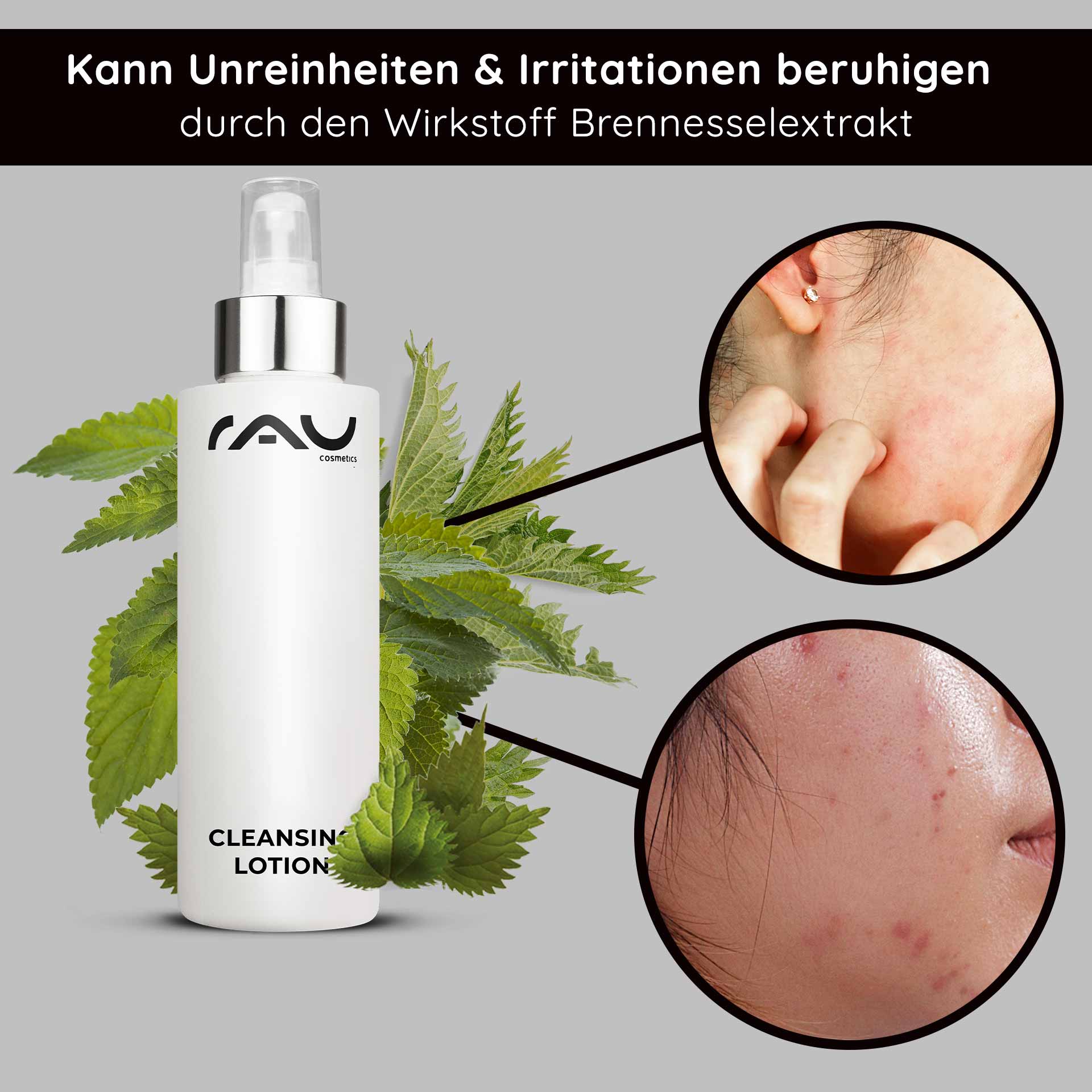 洁面乳 200 毫升 - 彻底清洁乳液 Flasche der RAU-Reinigungslotion mit Brennnesselblättern im Hintergrund, die die Vorteile bei der Linderung von Unreinheiten und Reizungen hervorhebt und Nahaufnahmen von Haut mit Unreinheiten zeigt.